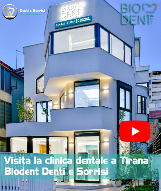 Clinica-dentale-a-Tirana-Biodent-Denti-e-Sorrisi