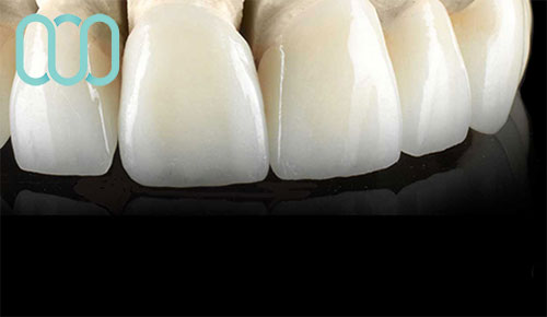 cura-destetica-dentale