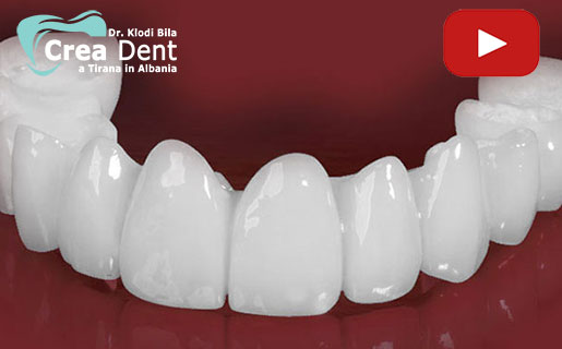 arcate-dentali-circolari-di-12-denti