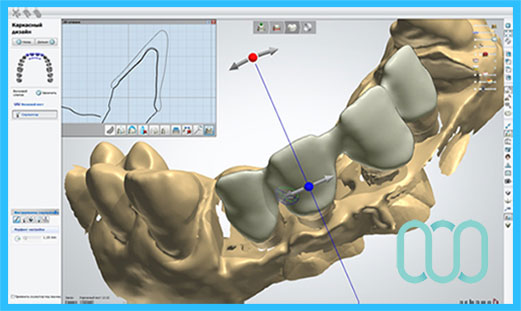 tecnologia-cad-cam-2