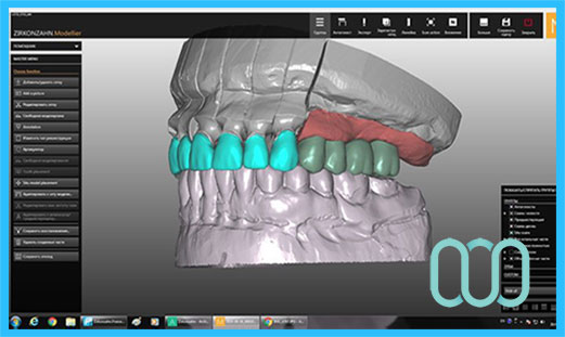 tecnologia-cad-cam-3