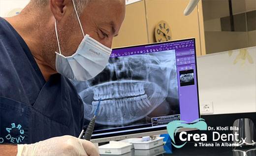 consulenza-del-dr-klodi-bila-per-le-cure-odontoiatriche-con-la-panoramica-2d