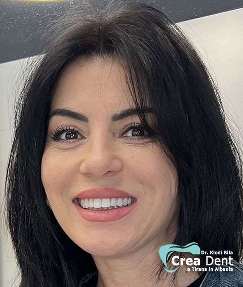 cura-dentale-del-paziente-1