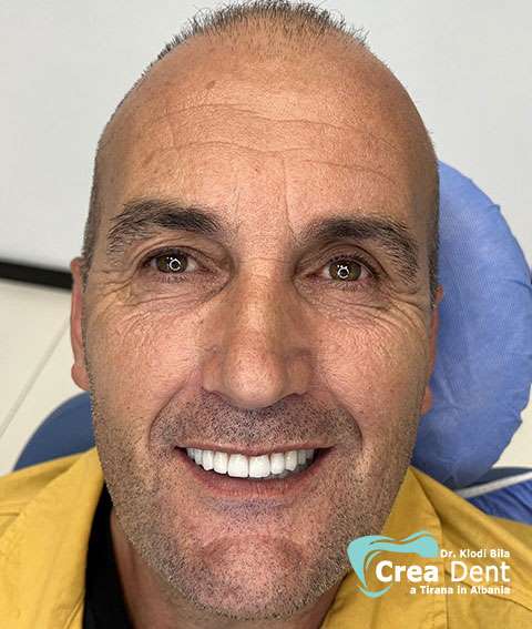 cura-dentale-del-paziente-2