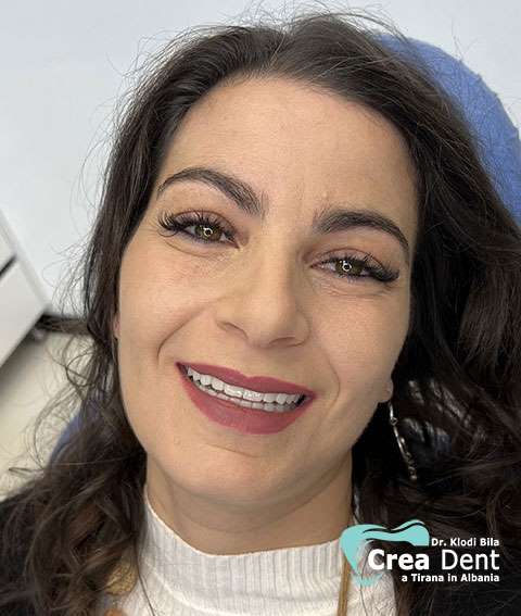 cura-dentale-del-paziente-3