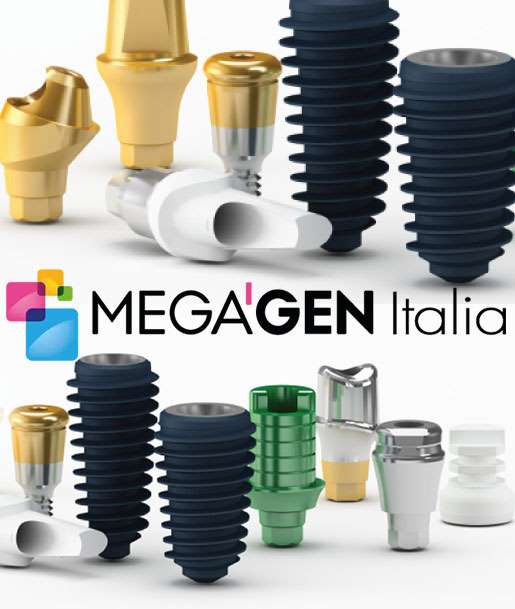 impianti-dentali-megagen-italia-nella-clinica-crea-dent