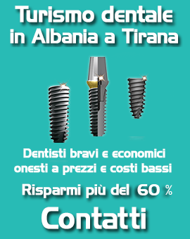 Dentista-a-ll on six prezzi economico bravo onesto low cost clinica dentale a prezzi bassi