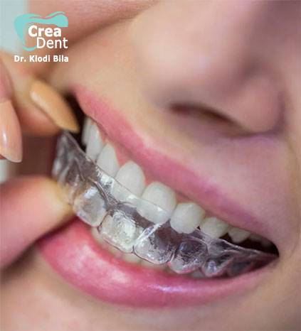 mascherine-trasparenti