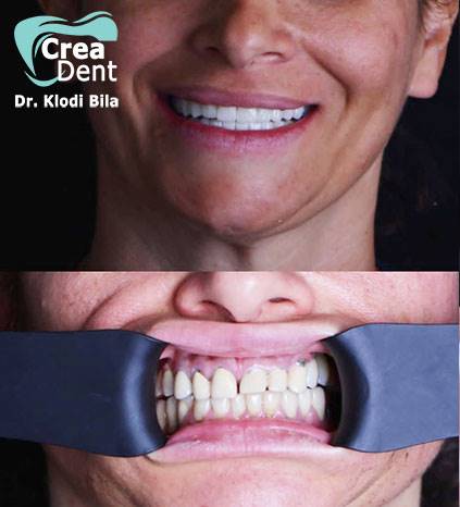 cure-ed-estetica-dentale