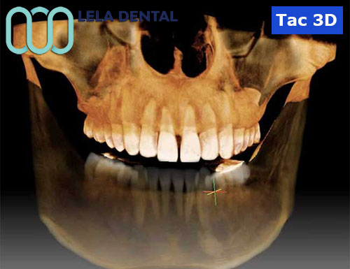 tac-3d