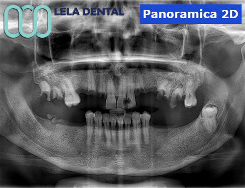 panoramica-2D