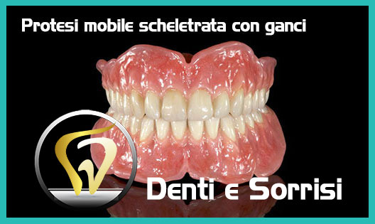 Prezzi-e-costi-Protesi-mobile-dentiera