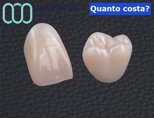 denti-in-zirconio-sigoli