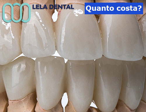 estetica-dentale-in-zirconio