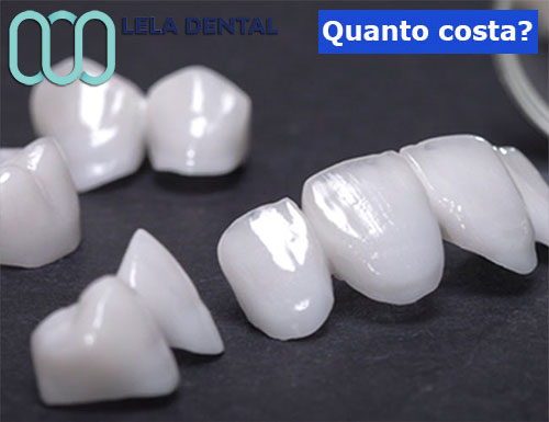 ponti-e-denti-in-zirconio