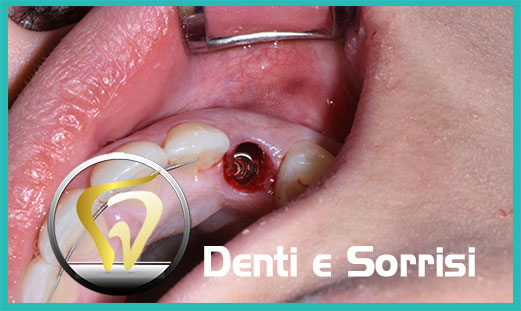 Denti e sorrisi clinica dentale 16