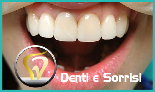 Denti e sorrisi clinica dentale 21