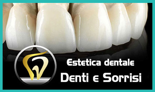 Estetica dentale 4