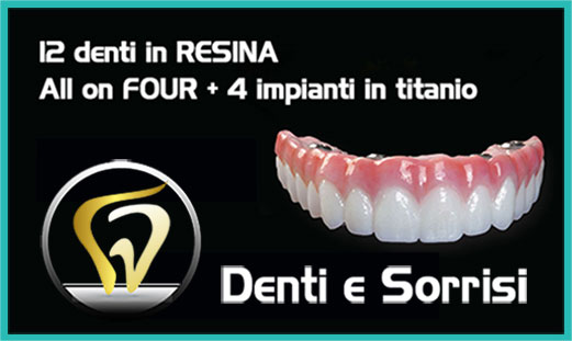 Impianto dentale premium prezzo 7