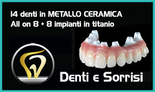 Implantologia dentale prezzi 9